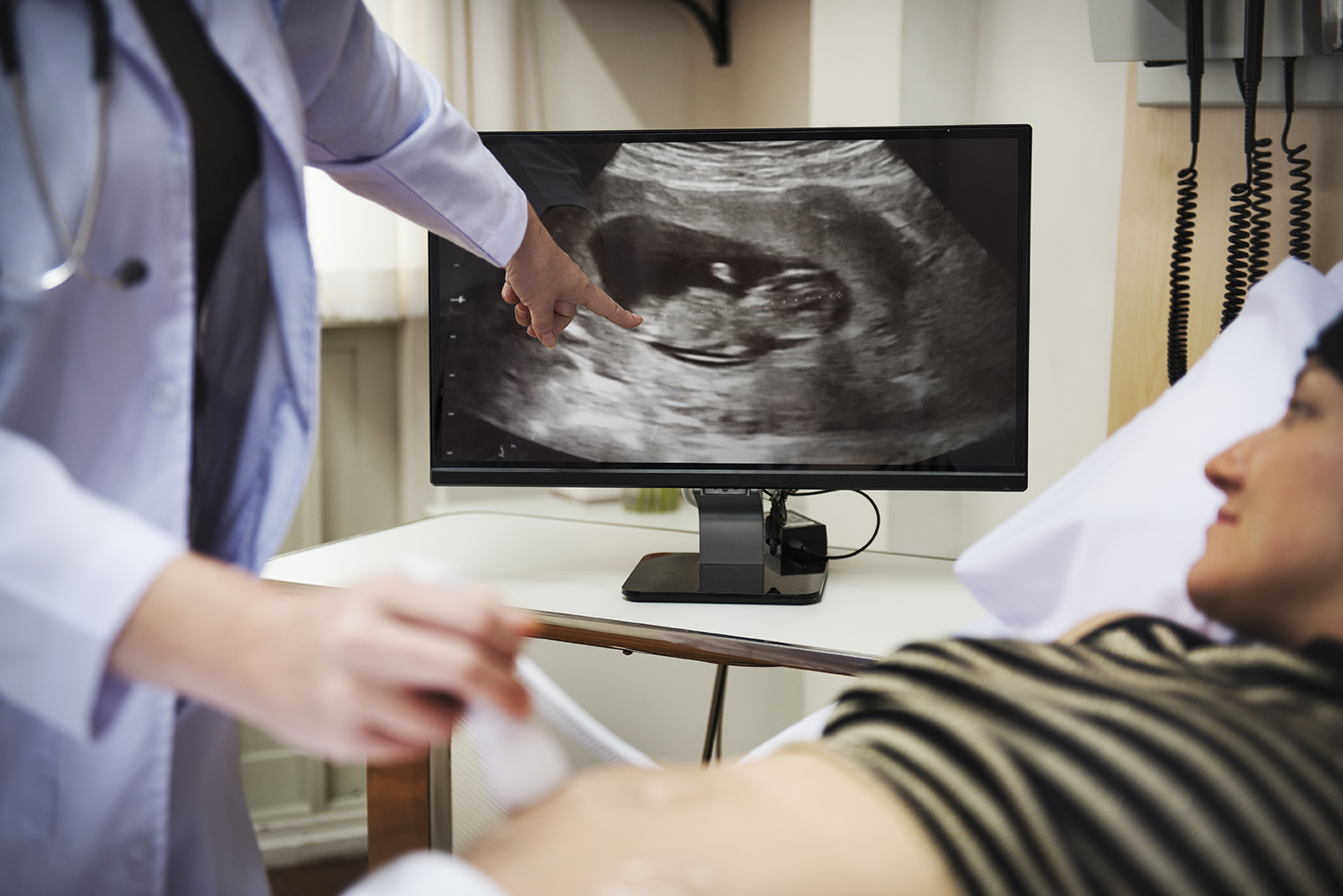 Doctora muestra a una madre su bebé en pantalla mientras realiza una ecografía
